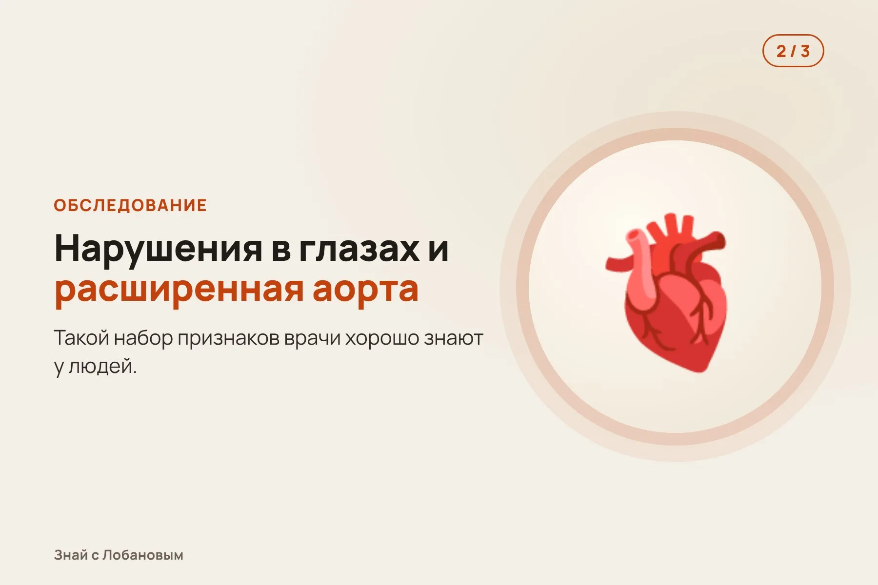 1. Коты-братья из приюта с необычно длинными лапами. Иллюстрация: «Знай с Лобановым» по данным Scientific Reports, условно · 2. Обследование показывает нарушения в глазах и расширенную аорту. Иллюстрация: «Знай с Лобановым» по данным Scientific Reports, условно · 3. Генетический анализ: обе копии гена FBN1 изменены. Иллюстрация: «Знай с Лобановым» по данным Scientific Reports, условно — 2 из 3