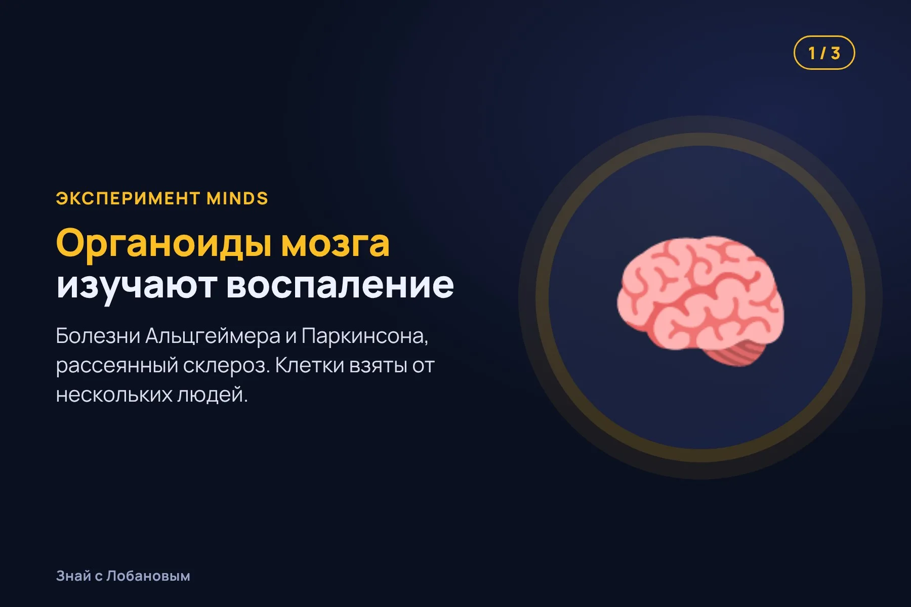 1. Органоиды мозга — крошечные комочки нервных клеток из стволовых клеток человека. Иллюстрация: «Знай с Лобановым» по данным NASA, условно · 2. Трёхмерные модели сердечной ткани проверяют, как сердце меняется в невесомости. Иллюстрация: «Знай с Лобановым» по данным NASA, условно · 3. Искусственную сетчатку собирают из тончайших слоёв, которые в невесомости ложатся ровнее. Иллюстрация: «Знай с Лобановым» по данным NASA, условно — 1 из 3