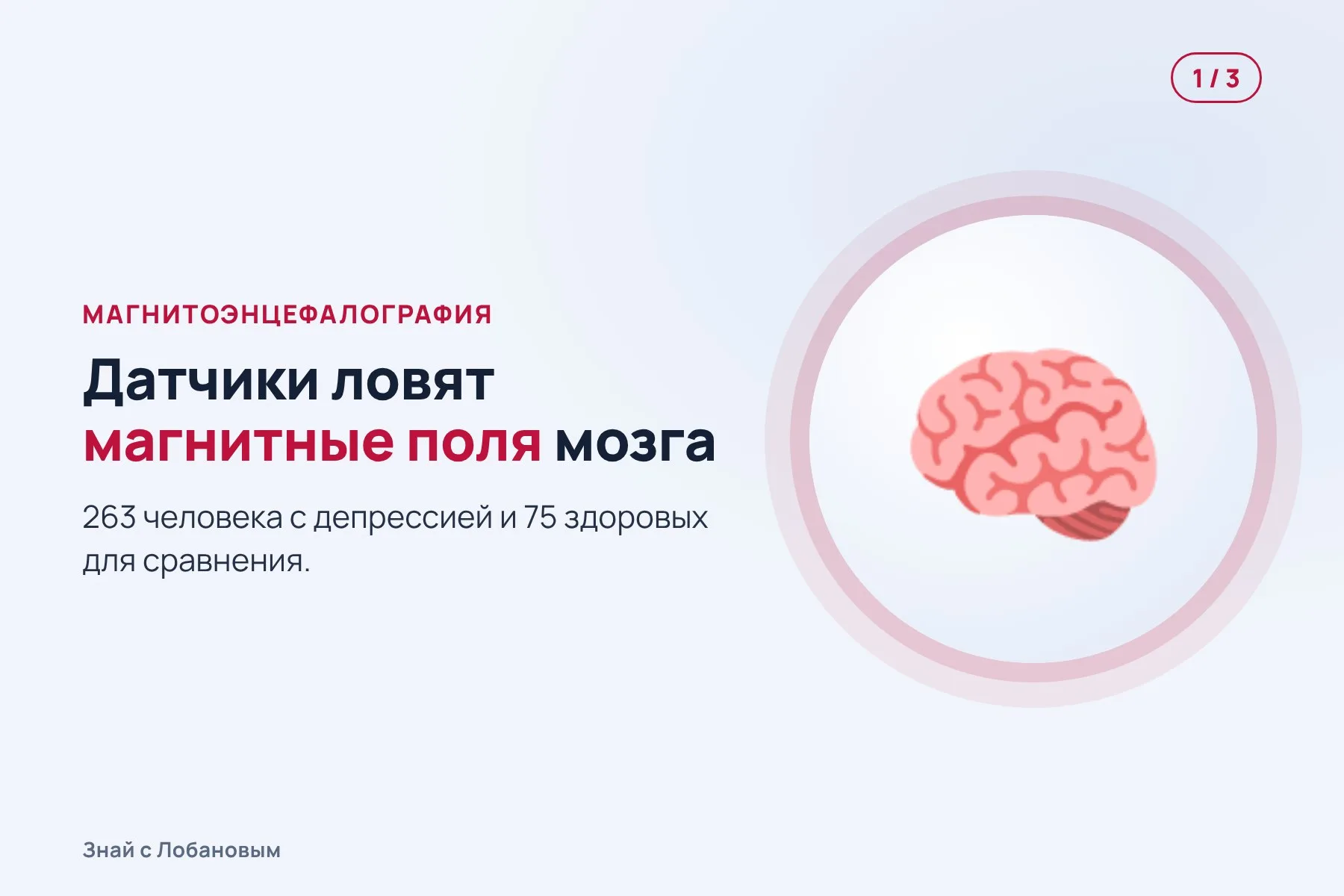 1. Датчики магнитоэнцефалографии ловят слабые магнитные поля работающего мозга. Иллюстрация: «Знай с Лобановым» по данным Хельсинкского университета, условно · 2. Компьютер сравнивает, насколько согласованно работают разные области мозга. Иллюстрация: «Знай с Лобановым» по данным Хельсинкского университета, условно · 3. Пациенты разделились на пять групп с разными рисунками связей. Иллюстрация: «Знай с Лобановым» по данным Хельсинкского университета, условно — 1 из 3