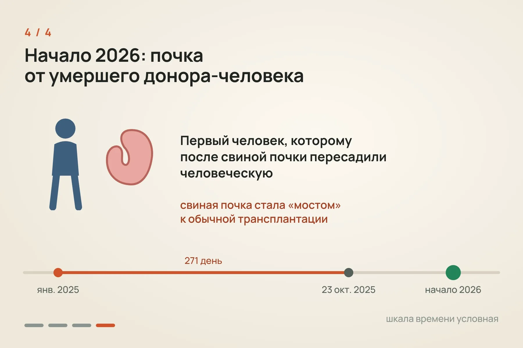 1. Январь 2025 года: пересадка, почка заработала сразу, и диализ стал не нужен · 2. 271 день обычной жизни: один ранний эпизод отторжения, свиных вирусов не нашли · 3. 23 октября 2025 года из-за крошечных тромбов почку удалили, антител против свиных тканей не нашли · 4. В начале 2026 года Эндрюс получил почку от умершего донора-человека. Схема: «Знай с Лобановым» по данным The Lancet и Массачусетской больницы общего профиля — 4 из 4