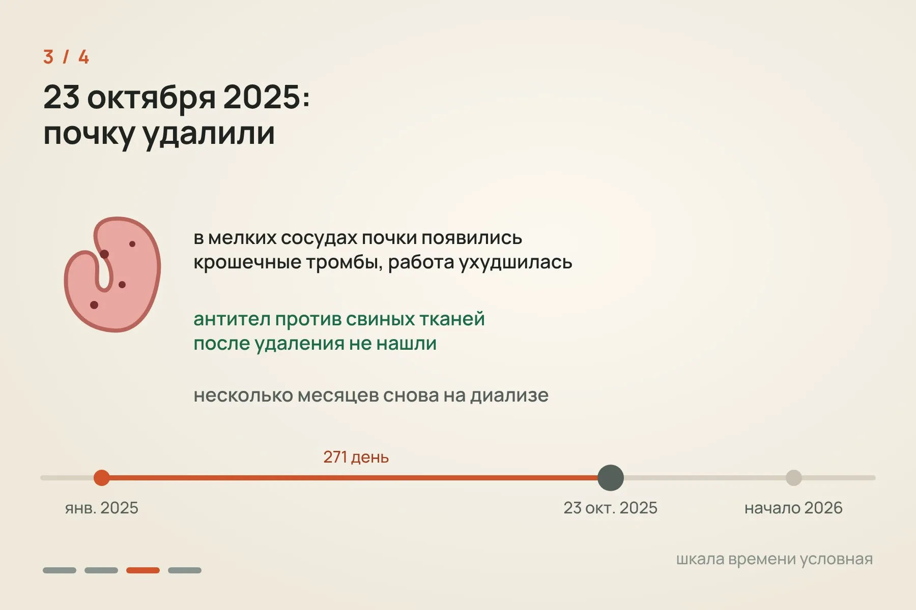 1. Январь 2025 года: пересадка, почка заработала сразу, и диализ стал не нужен · 2. 271 день обычной жизни: один ранний эпизод отторжения, свиных вирусов не нашли · 3. 23 октября 2025 года из-за крошечных тромбов почку удалили, антител против свиных тканей не нашли · 4. В начале 2026 года Эндрюс получил почку от умершего донора-человека. Схема: «Знай с Лобановым» по данным The Lancet и Массачусетской больницы общего профиля — 3 из 4