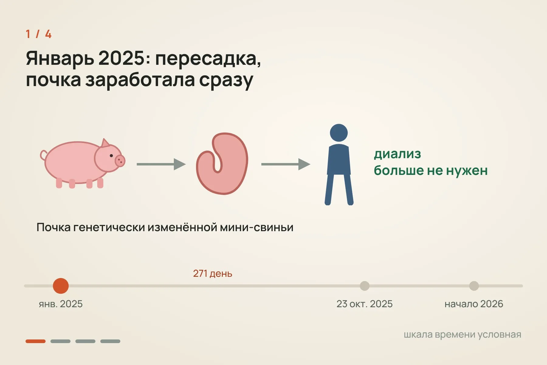 1. Январь 2025 года: пересадка, почка заработала сразу, и диализ стал не нужен · 2. 271 день обычной жизни: один ранний эпизод отторжения, свиных вирусов не нашли · 3. 23 октября 2025 года из-за крошечных тромбов почку удалили, антител против свиных тканей не нашли · 4. В начале 2026 года Эндрюс получил почку от умершего донора-человека. Схема: «Знай с Лобановым» по данным The Lancet и Массачусетской больницы общего профиля — 1 из 4